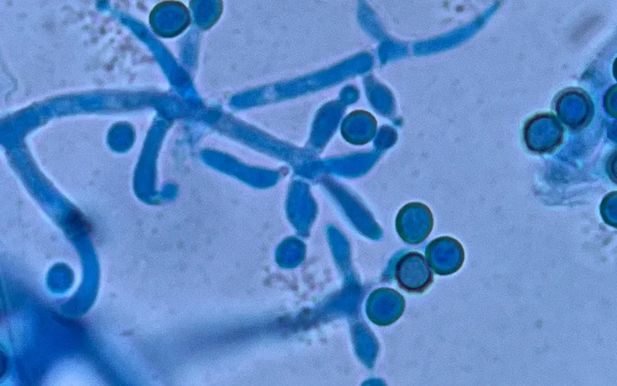 Rhizobacteria i Trichoderma